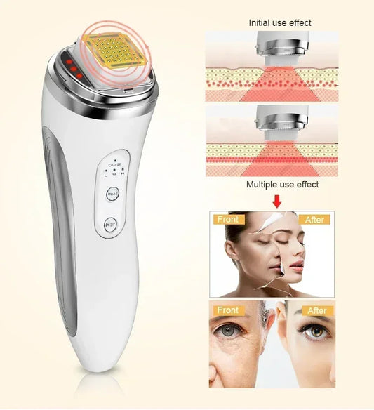 Máquina eléctrica de lifting facial con matriz de puntos, reafirmante de la piel, rejuvenecimiento, eliminación de arrugas, masajeador facial