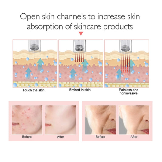 Máquina profesional de microagujas con cartucho, inalámbrica, para Derma MTS Pen, kit de belleza para el cuidado de la piel.