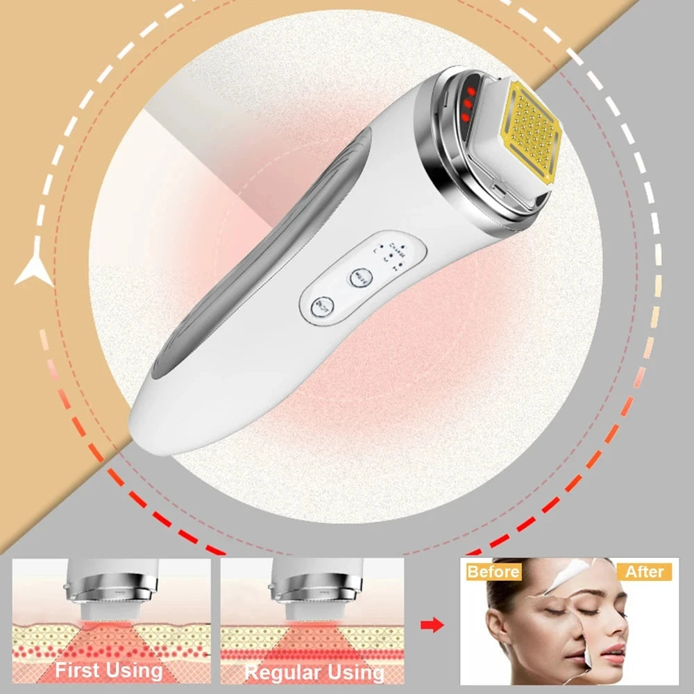 Máquina eléctrica de lifting facial con matriz de puntos, reafirmante de la piel, rejuvenecimiento, eliminación de arrugas, masajeador facial