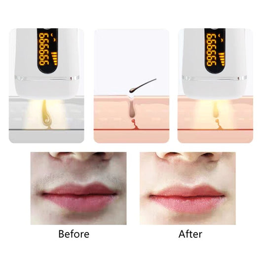 Depiladora láser fotónica IPL, multifuncional, portátil, sin dolor, para labios y axilas (DYM-011)