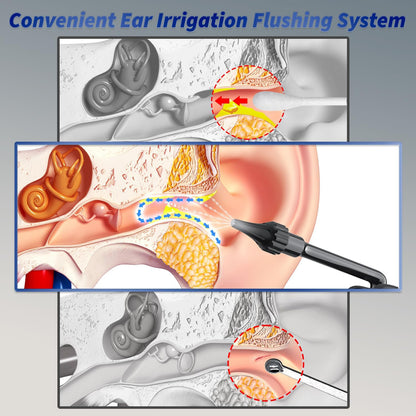 Limpiador de oídos eléctrico. Ideal para limpiar cerumen